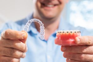Invisalign and traditional braces in sevenoaks
